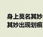 身上莫名其妙出现划痕是怎么回事 身上莫名其妙出现划痕 